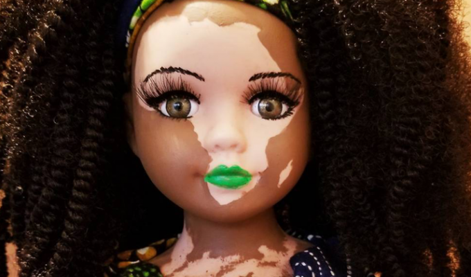 Художница создает куклы с витилиго для детей с редким кожным заболеванием (10 фото)