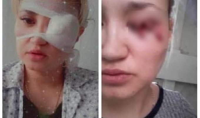 В Керчи девушка чуть не потеряла глаз, когда полезла гладить бездомную собаку (2 фото + видео)