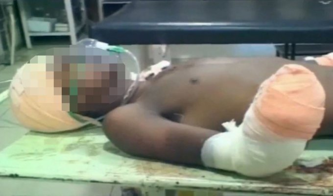 Мужчина отрезал парню руки после того, как узнал, что тот сделал с его 7-месячной дочкой (6 фото)