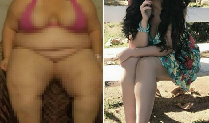 Бразильянка избавилась от 88 кг после операции на желудке (15 фото)