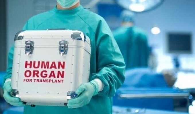 Китайские врачи попались на незаконной продаже органов (4 фото)