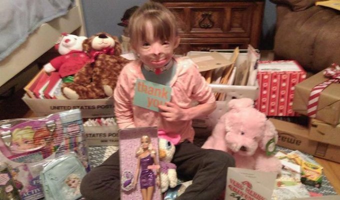 Обгоревшая девочка, потерявшая семью в пожаре, получила миллион рождественских открыток (7 фото + 1 видео)