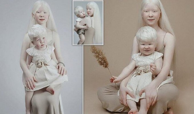 Сестры-альбиносы завоевывают модельный мир Казахстана (12 фото)