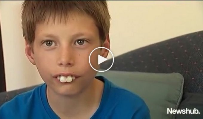 Над мальчиком все время издевались из-за его зубов