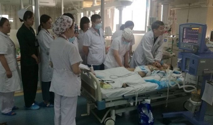 Пятичасовая эстафета. В Китае сразу 30 врачей пытались "завести" сердце ребёнка (1 фото)