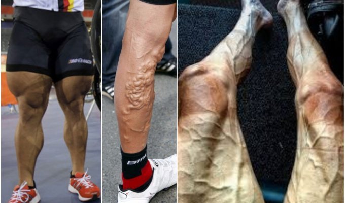 Велосипедисты шокируют видом своих ног! Этот пост лучше не смотреть тем, кто боится варикоза (16 фото)