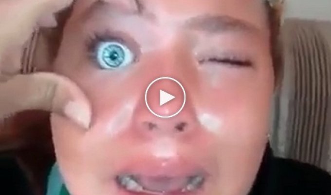 11-летняя жительница Бразилии пожалела, что вставила себе под веко кукольный глаз