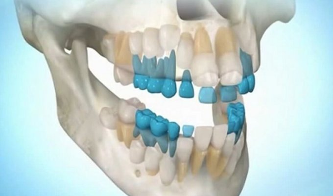 Теперь вырастить зубы станет возможным в любом возрасте (2 фото)