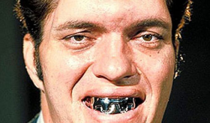Худшие зубы в мире (31 фото)
