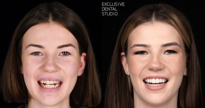 15 фото до и после того, как люди обратились к стоматологу (16 фото)
