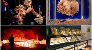 6 most shocking anatomical museums in the world (11 photos)