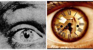 Clock-Eyed Boy Harold Maconaghy (5 photos)