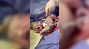 The beginning of the life of a child born in the amniotic sac