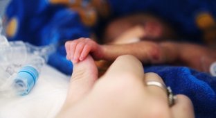 Тройное чудо: крошечные тройняшки, родившиеся на 23-й неделе, выжили и попали в Книгу Рекордов (5 фото + 1 видео)