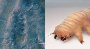 Demodex: mites that live on our skin (8 photos + 1 video)