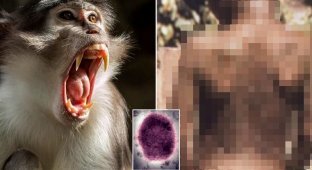 A tourist became infected with a deadly virus in a monkey park (4 photos)