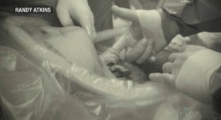 Рукопожатие в утробе (3 фото)