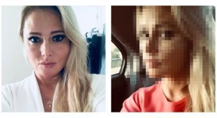 Недотянули: Дана Борисова продемонстрировала лицо после пластики (2 фото + 1 видео)