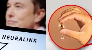 Elon Musk's company implanted an implant into the human brain for the first time (4 photos)