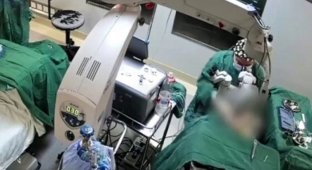 Doctor hit 82-year-old patient in the face three times during surgery (4 photos + 1 video)