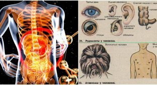 Какие органы у человека "лишние" (4 фото)