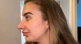 A woman paid $14 thousand for a nose job: it seems the plastic surgeon "heard her wrong" (4 photos + 1 video)