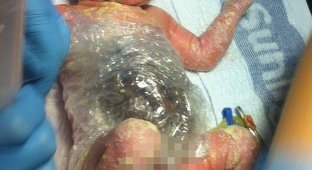 Новорожденную пришлось обмотать упаковочной пленкой, чтобы не повредить выпавшие внутренние органы (5 фото)
