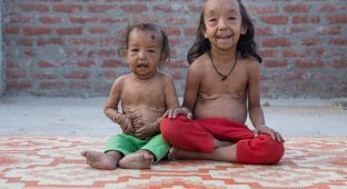 Семейная трагедия: сразу двое детей страдают от прогерии (4 фото)