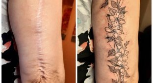 Люди, которые решили не прятать свои шрамы, а обыграть их с помощью татуировок (15 фото)