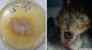"One of us. Beginning": in India, a killer fungus for the first time in history infected a person (5 photos)