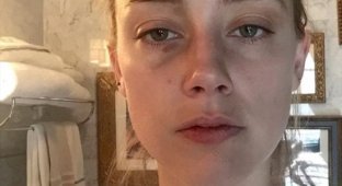 Супруга Джонни Деппа Эмбер Херд опубликовала новые фото с побоями на лице (4 фото)