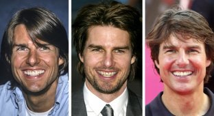 “The price of a Hollywood smile”: celebrities who wore braces (8 photos)