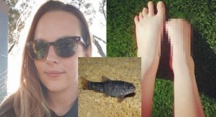 Спа из ада: девушка лишилась пальцев на ноге после пилинга рыбками в Таиланде (8 фото + 1 видео)