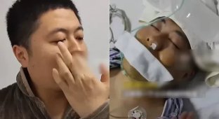 He loved to pick his nose and paid the price: the man underwent emergency surgery (2 photos)