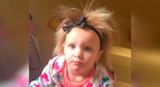 Малышке нельзя расчёсывать волосы из-за редкого заболевания, но ей это нравится (10 фото)
