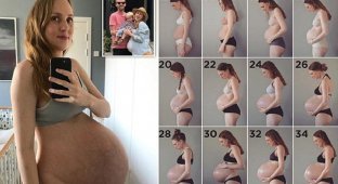 Родить тройню: будущая мама отчитывается о нелегкой миссии (8 фото + 1 видео)