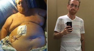 Чтобы не умереть от лишнего веса, американец скинул 160 кг (13 фото + 1 видео)