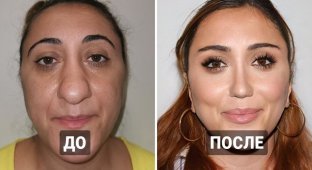 15 examples when people resorted to plastic surgery (16 photos)