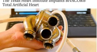 The first real cyborg: in Texas, a mechanical heart was successfully implanted into a person for the first time (3 photos)