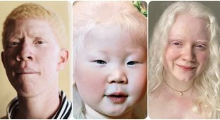 14 людина з альбінізмом, схожих на інопланетян (15 фото)