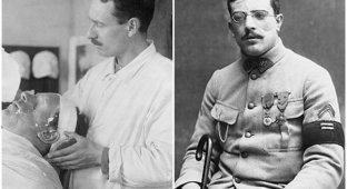 Пластическая хирургия Первой мировой: как хирурги восстанавливали изуродованные лица солдат (12 фото)
