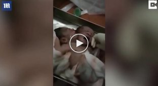Ребенок с двумя головами родился в Индии
