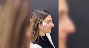 3 сестри та результати їхньої ринопластики