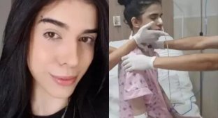 У Бразилії дівчина понюхала гострий перець і стала інвалідом (3 фото)