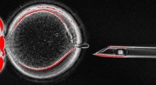 Учёные создали человеческие яйцеклетки из клеток кожи (3 фото)