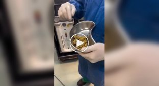 Що буде, якщо пити 2-3 літри кіл на день