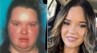 14 before and after photos of people who went through a transformation and were transformed beyond recognition (14 photos)