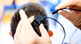 Scientists have developed a brain implant that translates thoughts into speech almost instantly (3 photos + 1 video)