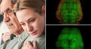 Нанотехнологии показали эффективность в лечении болезни Альцгеймера у мышей (3 фото)