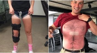 The insidious sun: 25 examples of unsuccessful tanning (26 photos)